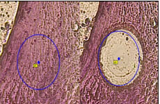 Image of laser microdissection